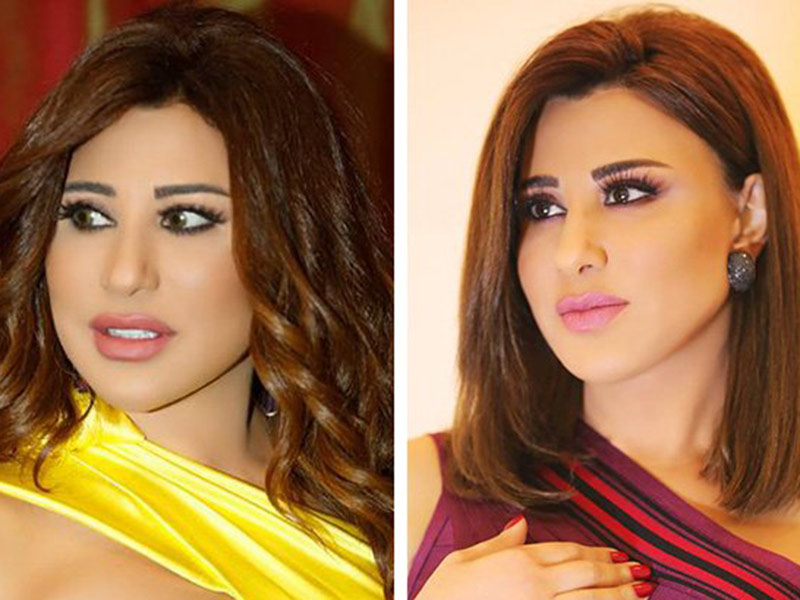 اضغط لمشاهدة الفيديو: نجوى كرم: بعض الفنانات يكذبن بشأن عمليات تجميل